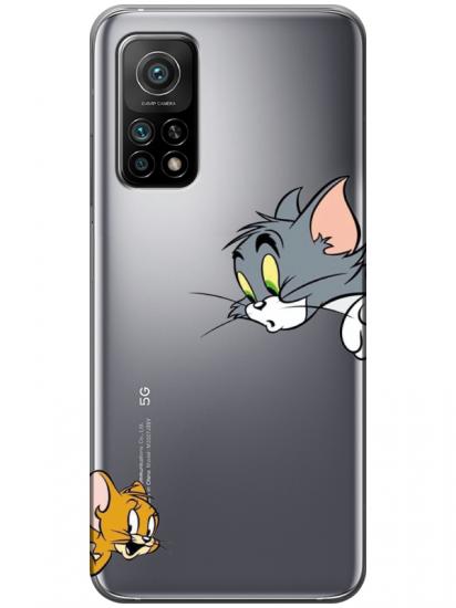 Xiaomi Mi 10T Tom And Jerry Şeffaf Telefon Kılıfı