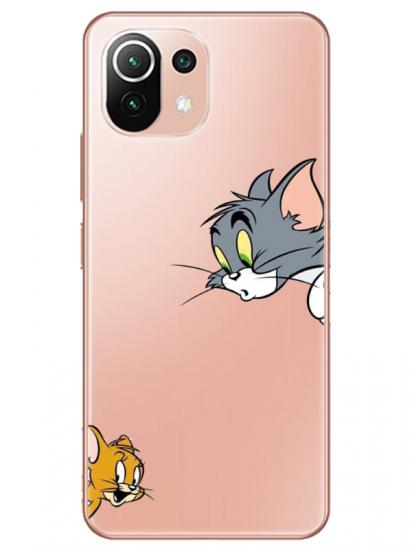 Xiaomi Mi 11 Tom And Jerry Şeffaf Telefon Kılıfı