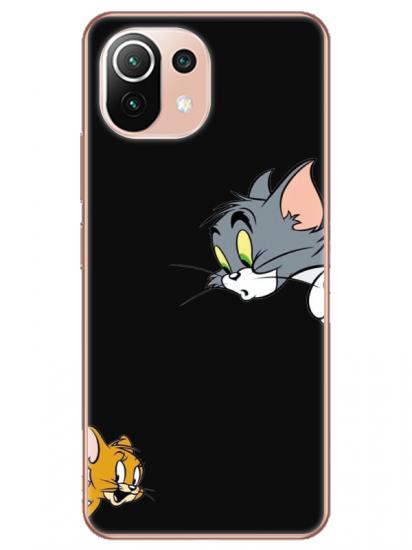 Xiaomi Mi 11 Tom And Jerry Siyah Telefon Kılıfı