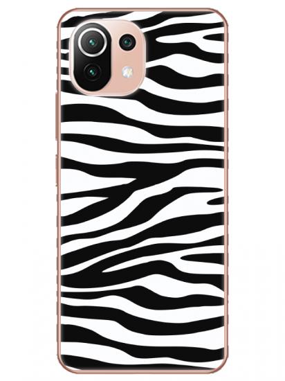 Xiaomi Mi 11 Zebra Desen Siyah Telefon Kılıfı