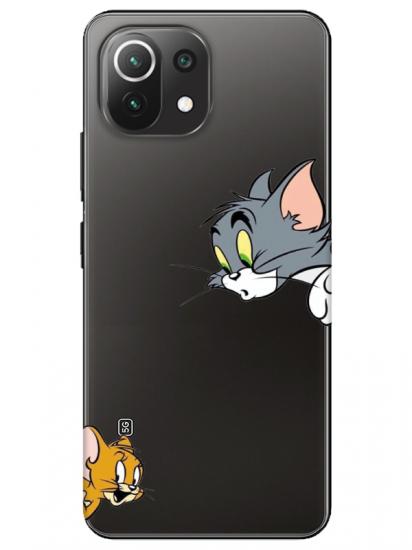 Xiaomi Mi 11 Lite Tom And Jerry Şeffaf Telefon Kılıfı