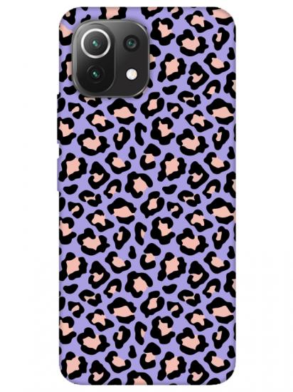 Xiaomi Mi 11 Lite Leopar Desenli Lila Telefon Kılıfı