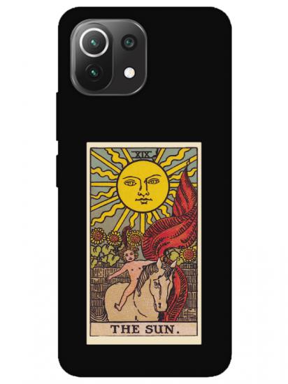 Xiaomi Mi 11 Lite The Sun Siyah Telefon Kılıfı