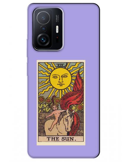 Xiaomi Mi 11T Pro The Sun Lila Telefon Kılıfı