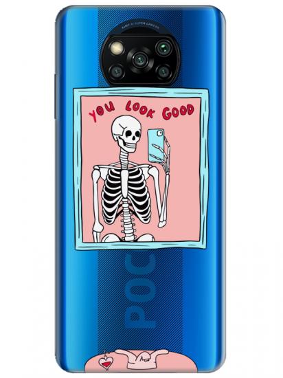 Poco X3 NFC You Look Good İskelet Şeffaf Telefon Kılıfı