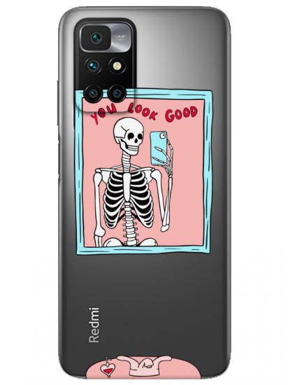 Redmi 10 2022 You Look Good İskelet Şeffaf Telefon Kılıfı