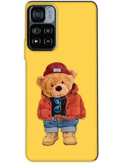 Redmi Note 11 Pro Teddy Bear Sarı Telefon Kılıfı