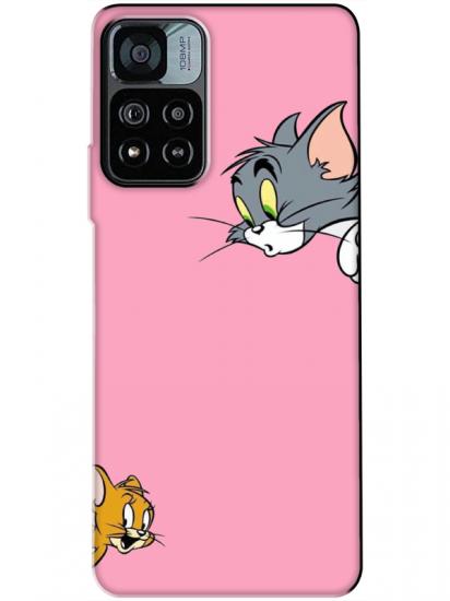 Redmi Note 11 Pro Tom And Jerry Pembe Telefon Kılıfı