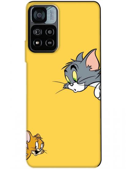 Redmi Note 11 Pro Tom And Jerry Sarı Telefon Kılıfı