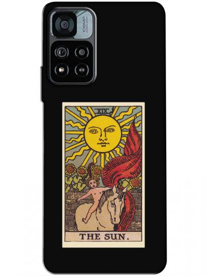 Redmi Note 11 Pro The Sun Siyah Telefon Kılıfı