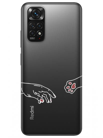 Redmi Note 11S Hand And Paw Şeffaf Telefon Kılıfı