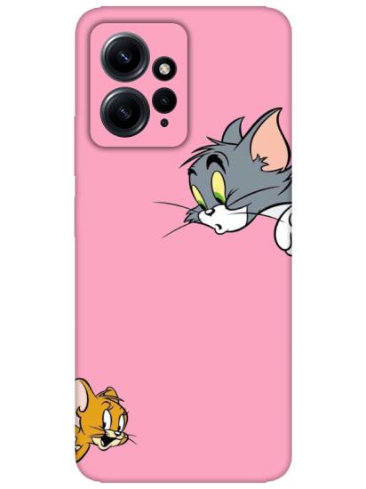 Redmi Note 12 4g Tom And Jerry Pembe Telefon Kılıfı